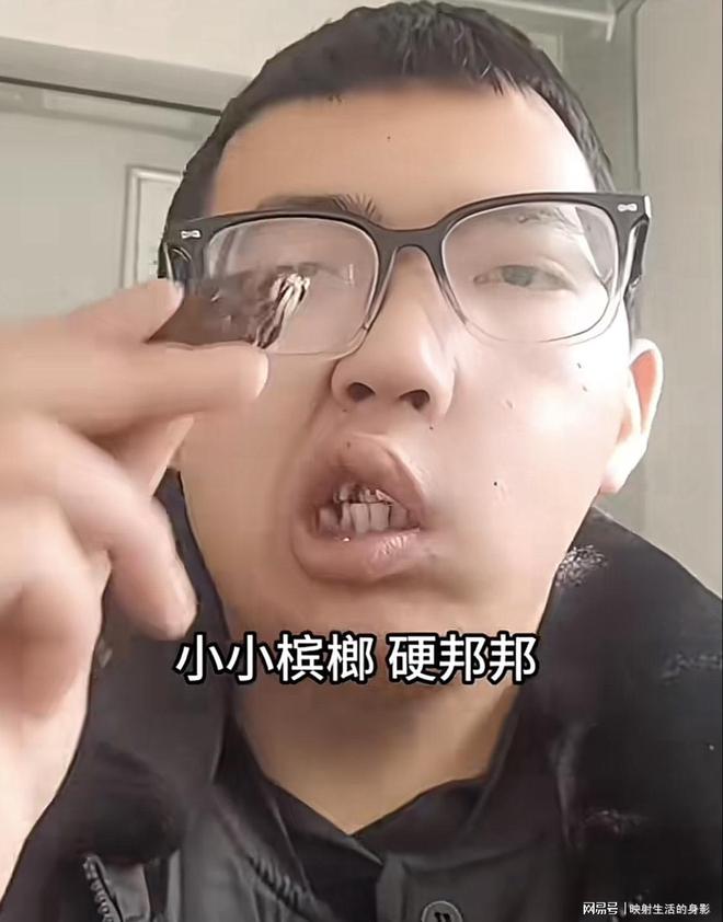 部变形还边嚼边劝大家别碰槟榔凯发平台男子嚼槟榔七年导致脸(图3)
